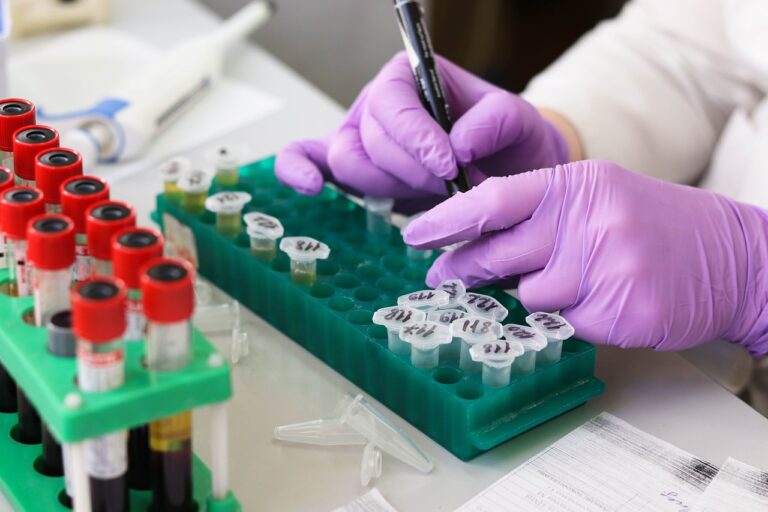 close up of hands writing on eppi tubes in lab